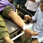 युवक को सांप ने डसा, डॉक्टरों ने मृत घोषित किया